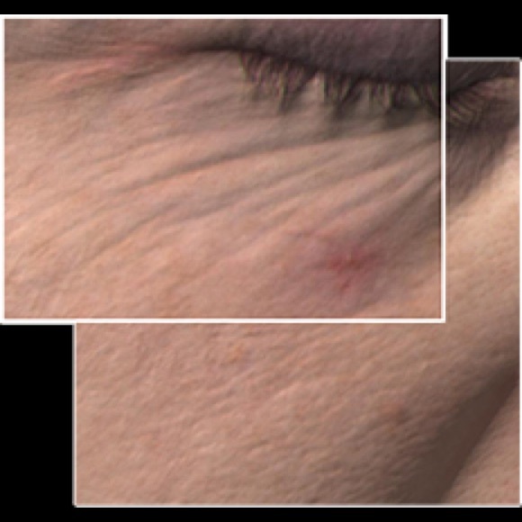 TimeWise® Miracle Set 3D™! - Picture 3 of 6